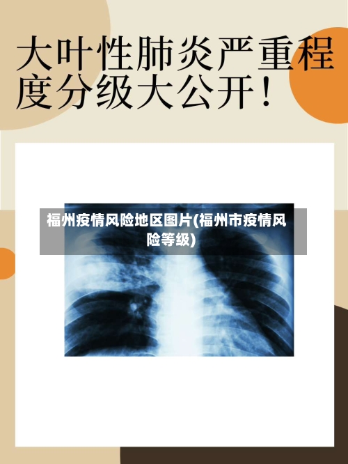 福州疫情风险地区图片(福州市疫情风险等级)-第1张图片